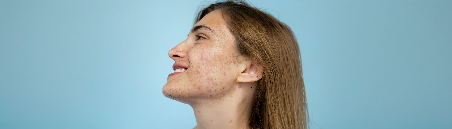 Pigmentation Treatments