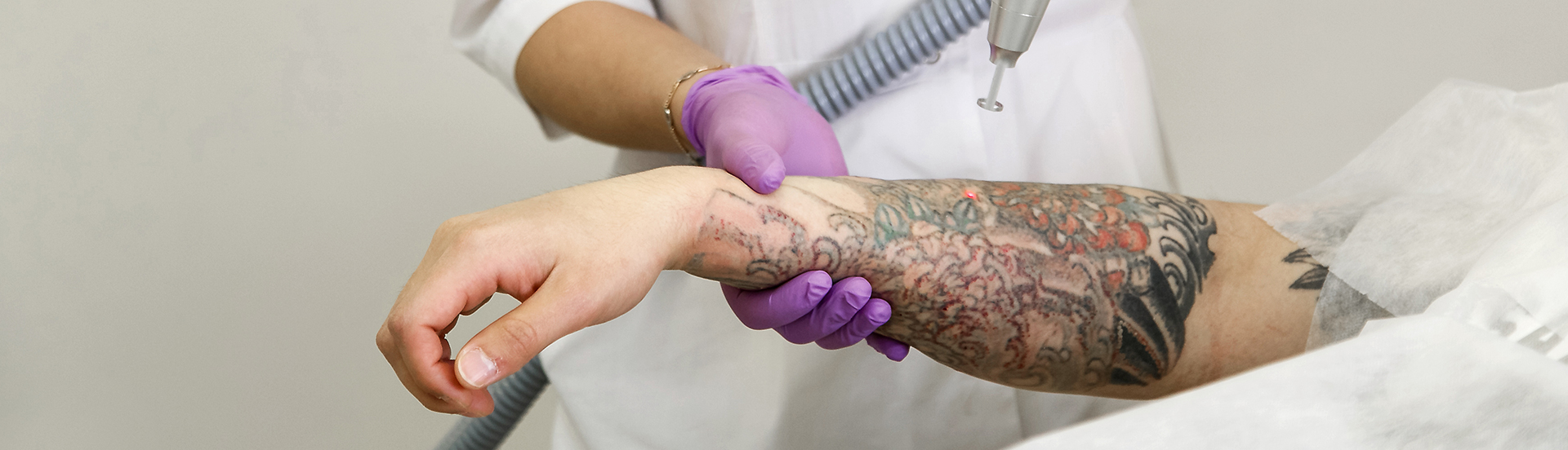 Tattoo Removal & Skin Refinement